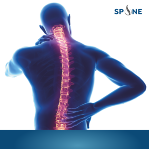 SPINE (FOAM)